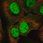 Merck Anti-C18orf25 antibody produced in rabbit