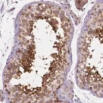 Merck Anti-SSSCA1 antibody produced in rabbit