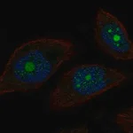 Merck Anti-POP1 antibody produced in rabbit