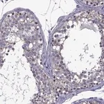 Merck Anti-ZNF646 antibody produced in rabbit