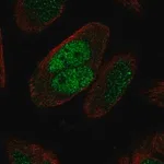 Merck Anti-MSH2 antibody produced in rabbit
