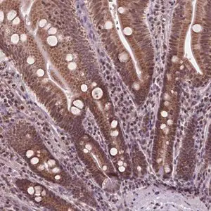 Merck Anti-NDUFA10 antibody produced in rabbit