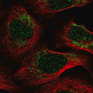 Merck Anti-PET100 antibody produced in rabbit