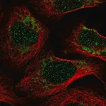 Merck Anti-PET100 antibody produced in rabbit