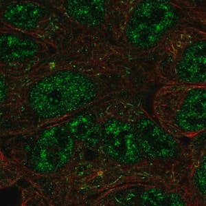 Merck Anti-NR0B1 antibody produced in rabbit