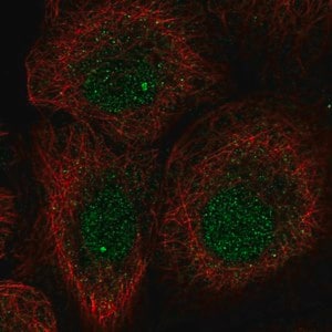 Merck Anti-L3MBTL1 antibody produced in rabbit