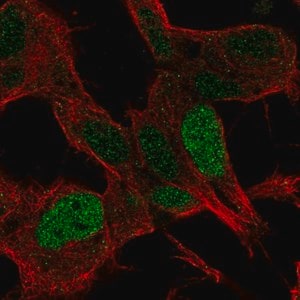 Merck Anti-SSBP2 antibody produced in rabbit