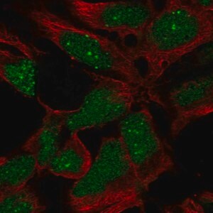 Merck Anti-RP11-302B13.5 antibody produced in rabbit