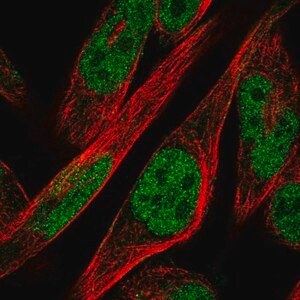 Merck Anti-ZNF594 antibody produced in rabbit