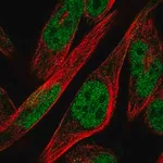 Merck Anti-ZNF594 antibody produced in rabbit