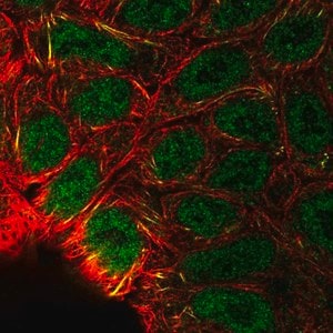 Merck Anti-EPAS1 antibody produced in rabbit