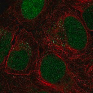 Merck Anti-CTDP1 antibody produced in rabbit