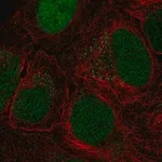 Merck Anti-CTDP1 antibody produced in rabbit