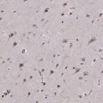 Merck Anti-ARRB1 antibody produced in rabbit