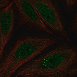 Merck Anti-MKNK2 antibody produced in rabbit