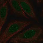 Merck Anti-MKNK2 antibody produced in rabbit