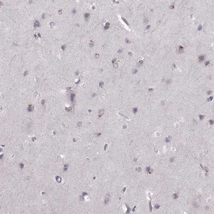 Merck Anti-OPRD1 antibody produced in rabbit