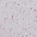 Merck Anti-OPRD1 antibody produced in rabbit