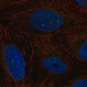 Merck Anti-ERCC6 antibody produced in rabbit