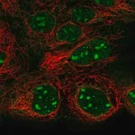 Merck Anti-SNAPC1 antibody produced in rabbit