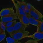 Merck Anti-UNC79 antibody produced in rabbit