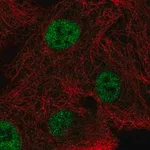 Merck Anti-NEIL2 antibody produced in rabbit