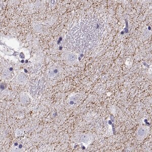 Merck Anti-SLC18A2 antibody produced in rabbit