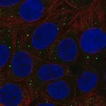 Merck Anti-THBS3 antibody produced in rabbit