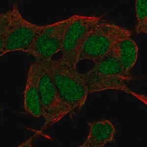 Merck Anti-BCOR antibody produced in rabbit