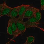 Merck Anti-BCOR antibody produced in rabbit