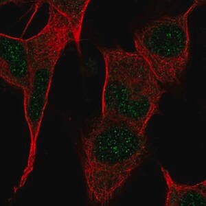 Merck Anti-PPP1R17 antibody produced in rabbit