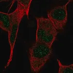 Merck Anti-PPP1R17 antibody produced in rabbit