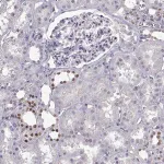 Merck Anti-LHX1 antibody produced in rabbit