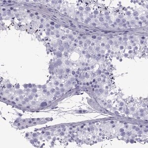 Merck Anti-SPANXD antibody produced in rabbit