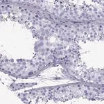 Merck Anti-SPANXD antibody produced in rabbit