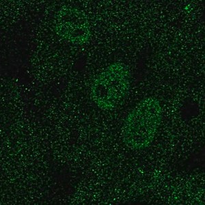 Merck Anti-TAL1 antibody produced in rabbit