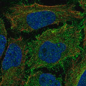 Merck Anti-ROBO1 antibody produced in rabbit