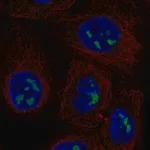 Merck Anti-ADAMTS12 antibody produced in rabbit