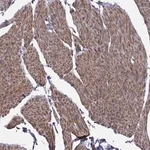 Merck Anti-TMEM158 antibody produced in rabbit