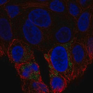 Merck Anti-UCP2 antibody produced in rabbit