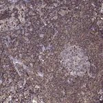 Merck Anti-ACAP1 antibody produced in rabbit