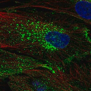 Merck Anti-CHIC2 antibody produced in rabbit