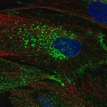 Merck Anti-CHIC2 antibody produced in rabbit