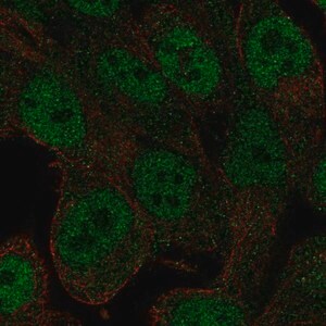 Merck Anti-RNF113A antibody produced in rabbit
