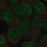 Merck Anti-RNF113A antibody produced in rabbit