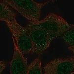 Merck Anti-SLC43A3 antibody produced in rabbit