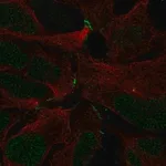 Merck Anti-ZNF536 antibody produced in rabbit