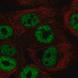 Merck Anti-BNC1 antibody produced in rabbit