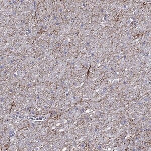 Merck Anti-TMEM155 antibody produced in rabbit