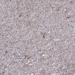 Merck Anti-TMEM155 antibody produced in rabbit